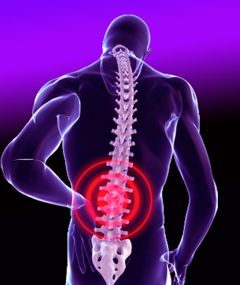back surgery-resized-600